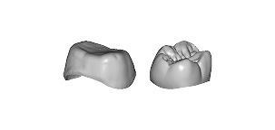 Coping/Full Crown
